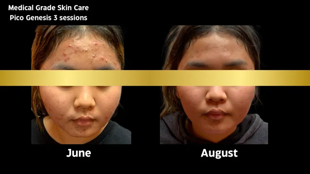 Skincare & Pico Genesis gallery image
