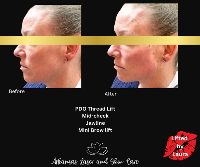 PDO threads gallery image
